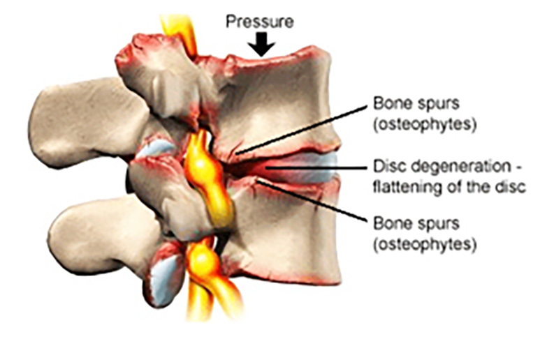 SpineMED