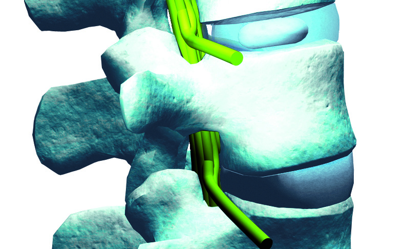 SpineMED